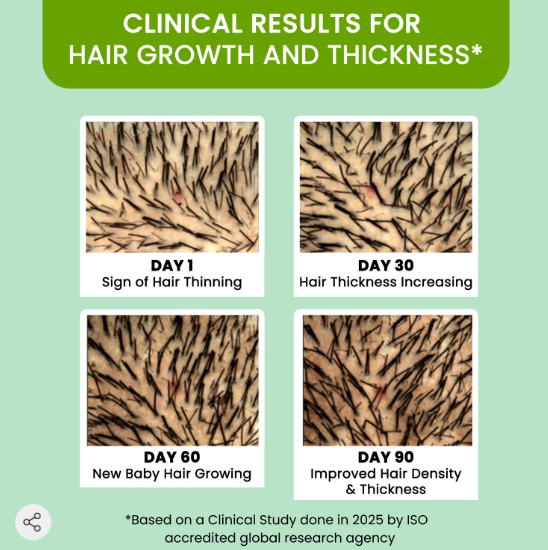 Alps Rosemary Water 100-ml hair spray for regrowth (Pack of-3)