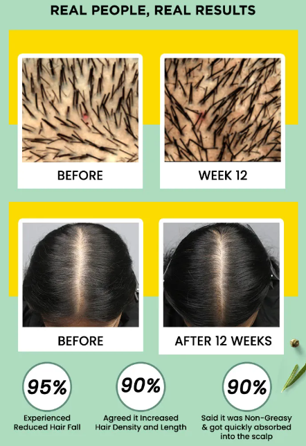 Alps Rosemary Water 100-ml hair spray for regrowth (Pack of-3)